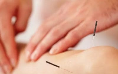 Acupuncture in North Vancouver: Safe, Gentle, and Effective for Pain Relief