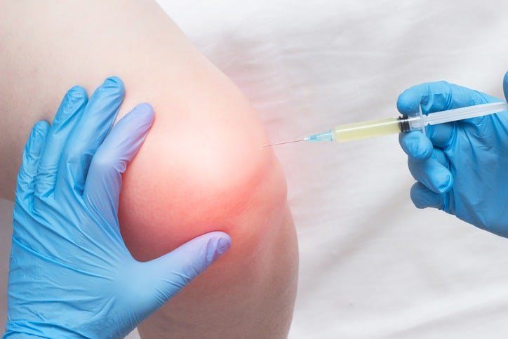 Get Prolotherapy for Knee or Lower Back Pain