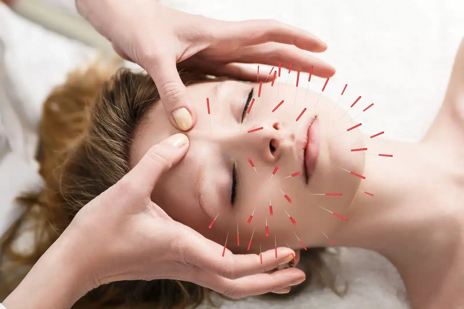 Active Therapy | Acupuncture North Vancouver