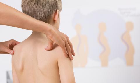 Scoliosis | North Vancouver | Active Therapy Clinic