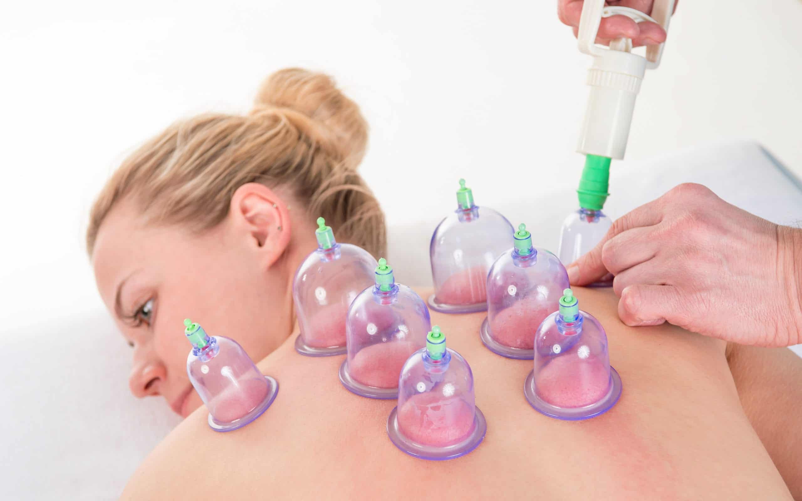 Cupping therapy for chronic neck and back pain